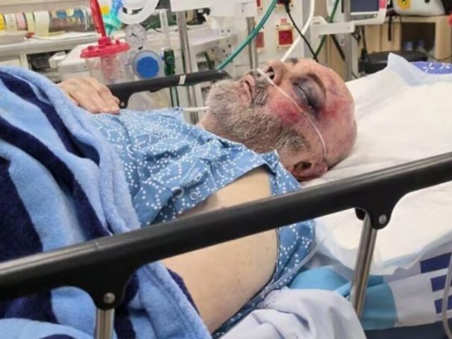 בוריס קוניק עדיין מאושפז לאחר התקיפה החמורה