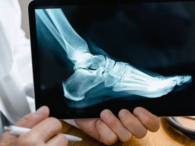 PEXELS